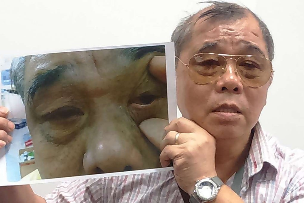 Lee Yau-ming said he complained about the pain. Photo: Elizabeth Cheung