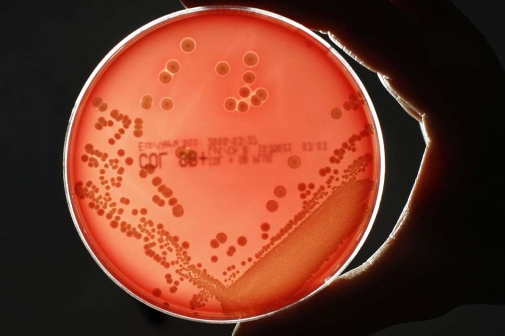 MRSA (Methicillin-resistant Staphylococcus aureus) bacteria is seen in a petri dish in a microbiological laboratory in Berlin, Germany. Photo: Reuters