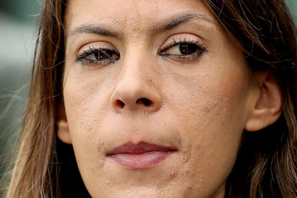 Marion Bartoli at first thought her ailment was due to jet lag. Photo: AFP