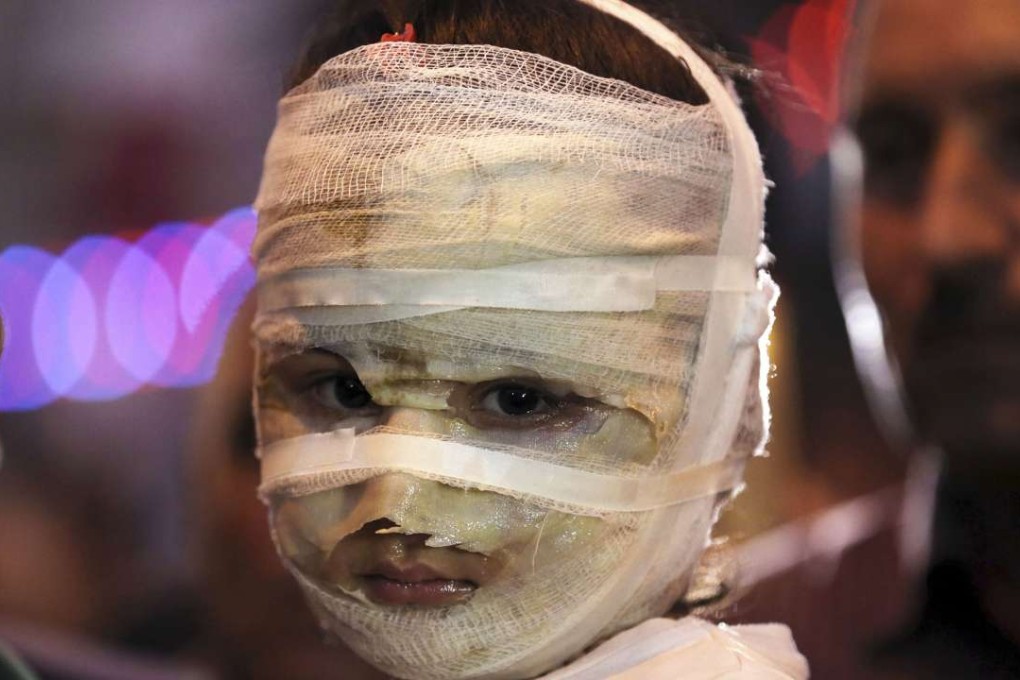 A four-year-old girl is carried by her father at the scene of a massive suicide truck bomb attack in Karada, Iraq, this month. Photo: AP