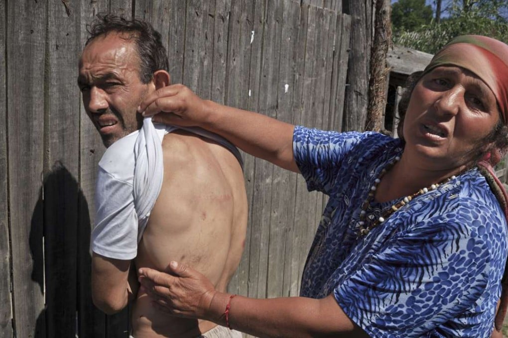 A woman in Gamacesti, Romania, shows bruises on a man's body, allegedly from being hit by police during Wednesday’s raid on the homes of people suspected of enslaving vulnerable boys and young men. Photo: AP