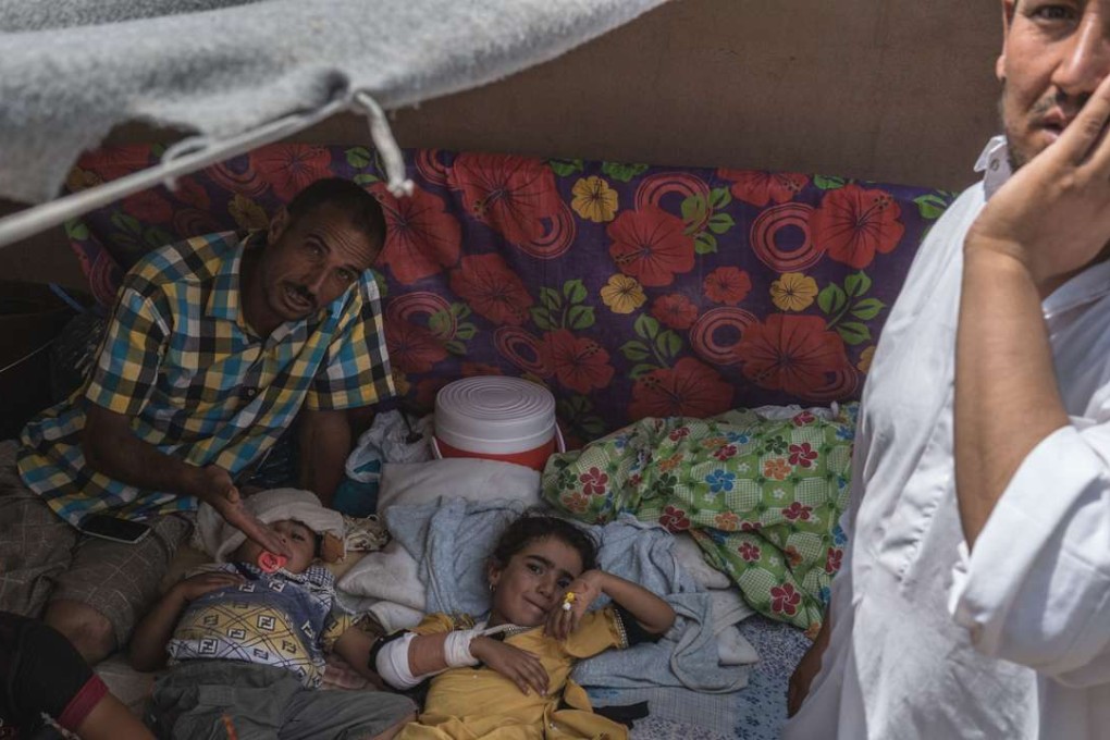 A child at Dibaga camp for internally displaced civilians in Iraq recovers on Sunday from injuries her father says she suffered when they fled fighting in their village. Photo: AP