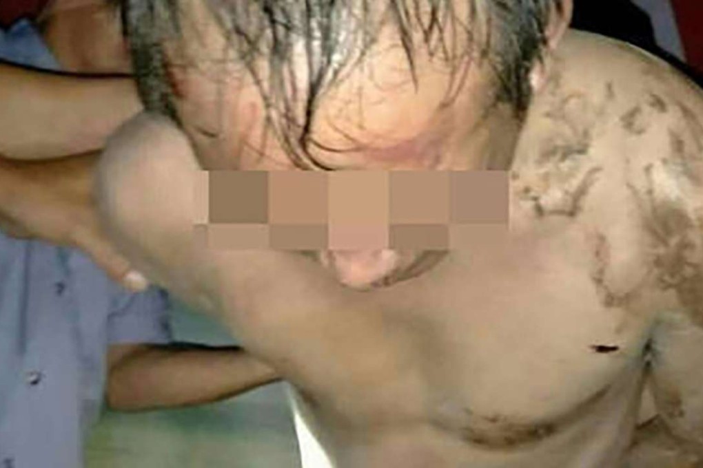 The high school teacher was said to have been beaten and stripped naked by the family of one of his female pupils. Photo: SCMP Pictures
