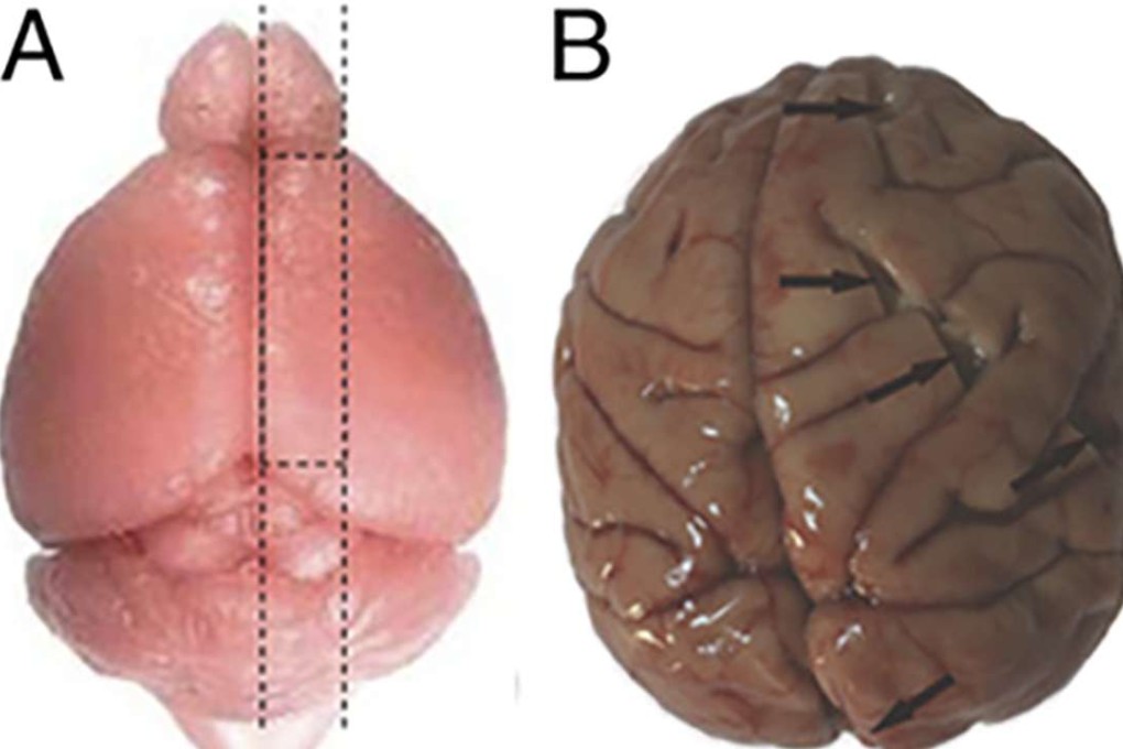 An enlarged picture of a mouse brain, left, next to a monkey brain used in the study. The dash lines indicate where tissue samples were taken. Photo: Proceedings of the National Academy of Sciences