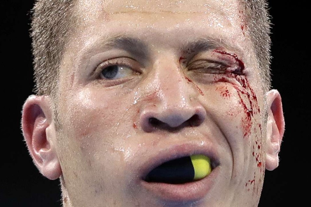 Algeria’s Ilyas Abbadi was cut during his bout with Congo’s Mpi Anauel Ngamissengue and said he would prefer to wear a headguard. Photo: AP