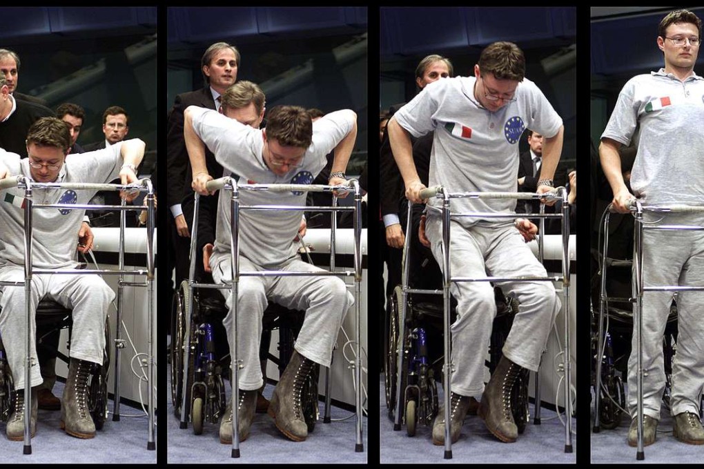 The innovative therapy combined several techniques to stimulate parts of the brain that once controlled the patients’ long-inactive limbs. Photo: Reuters
