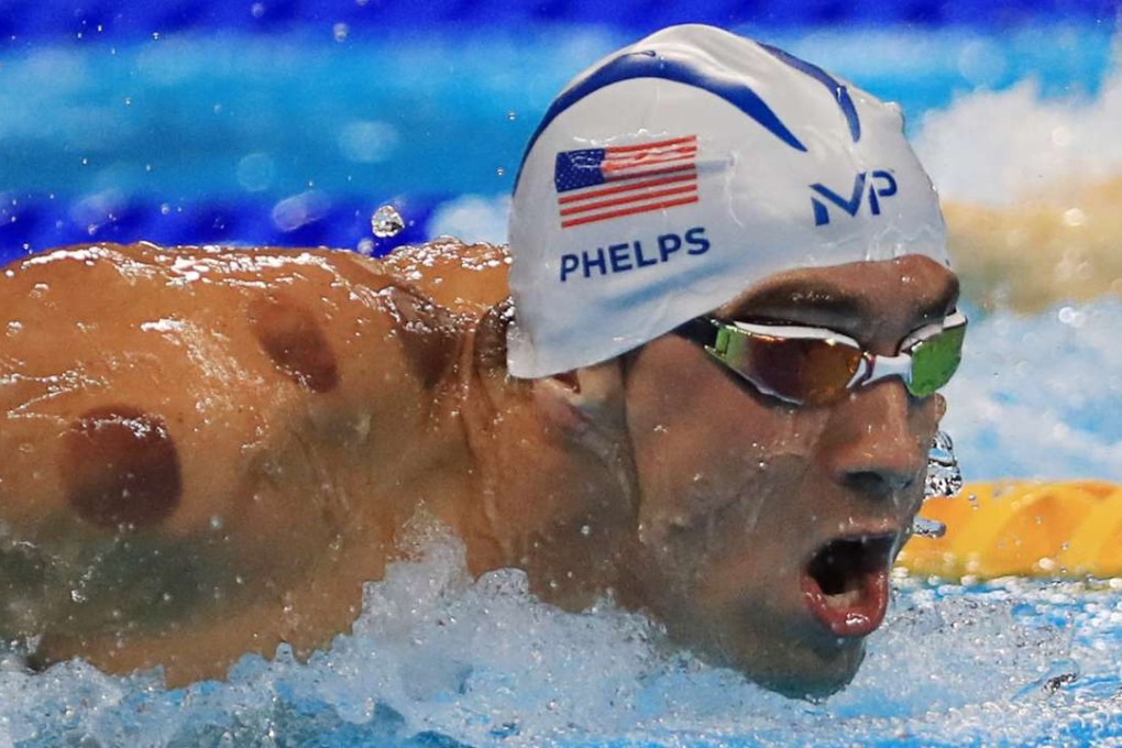 Michael Phelps is seen with red cupping marks as he competes. Photo: Reuters