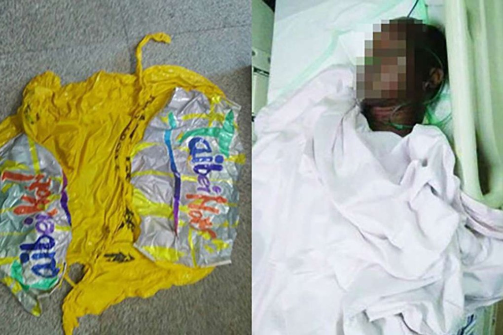 The balloon that exploded and one of the men injured. Photo: Xhby.net