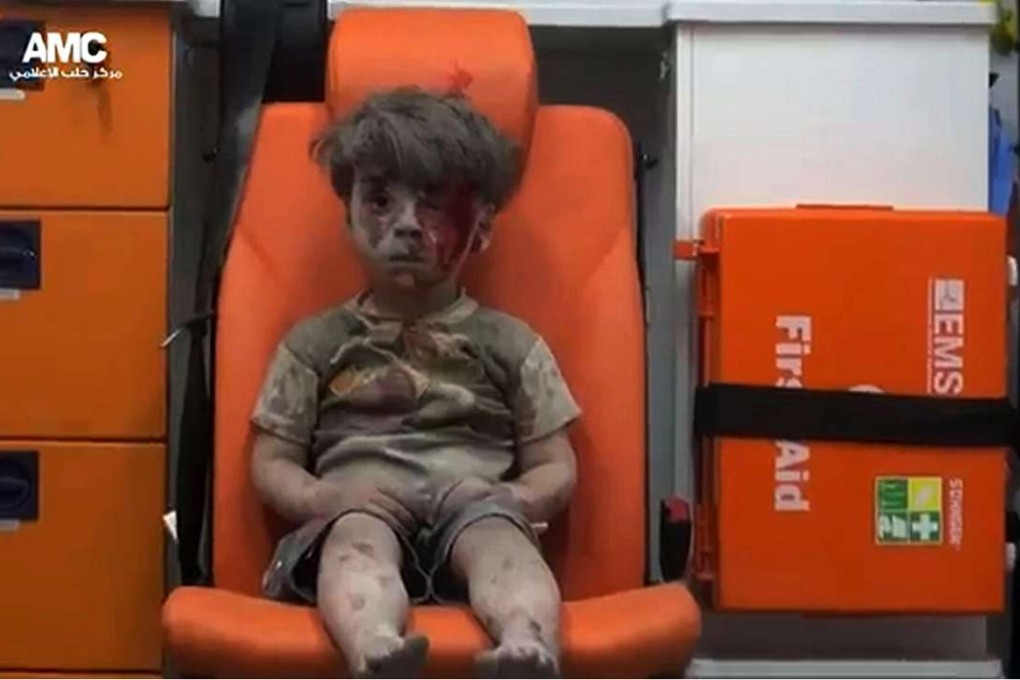 Omran Daqneesh sits bloodied and battered in an ambulance after being rescued from the rubble of a building hit by an air strike in the rebel-held Qaterji neighbourhood of the northern Syrian city of Aleppo. Photo: AFP