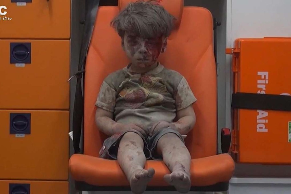 Omran pictured in an ambulance after he was pulled out of a building hit by an air strike, in Aleppo, Syria. Photo: AP