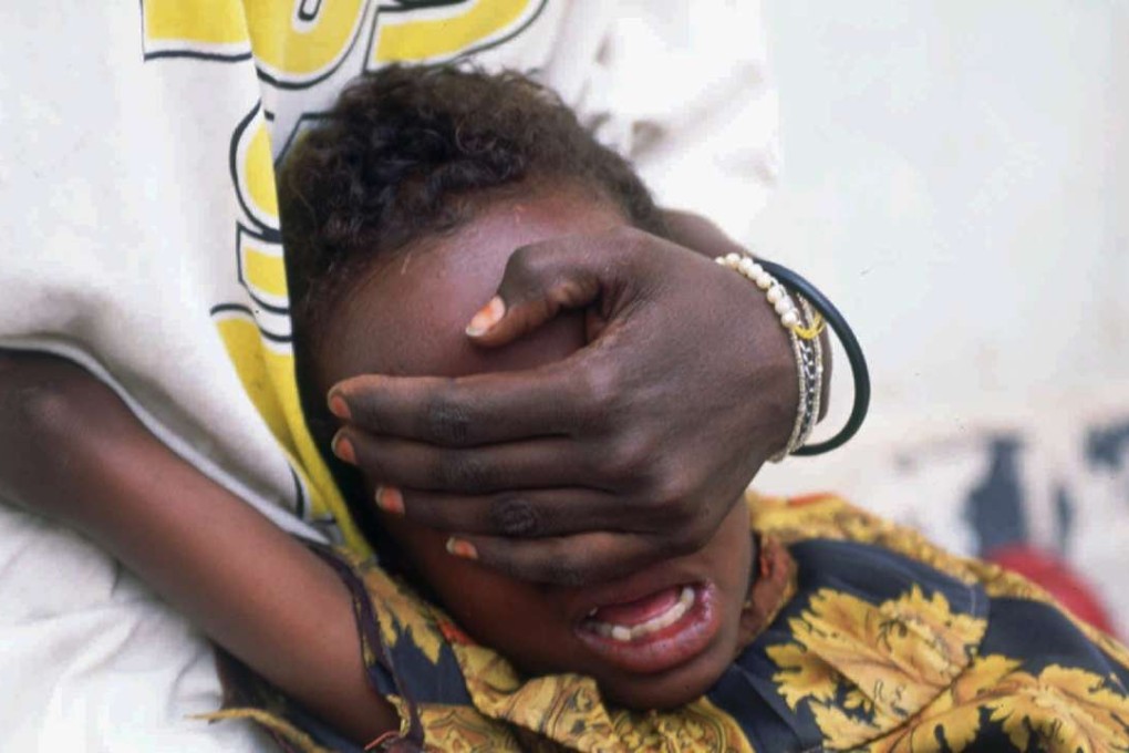 A six-year-old girl, held down by her sister, screams in pain while undergoing genital mutilation in Hargeisa, Somalia. The practice remains widespread in parts of the Middle East and Africa. Photo: AP