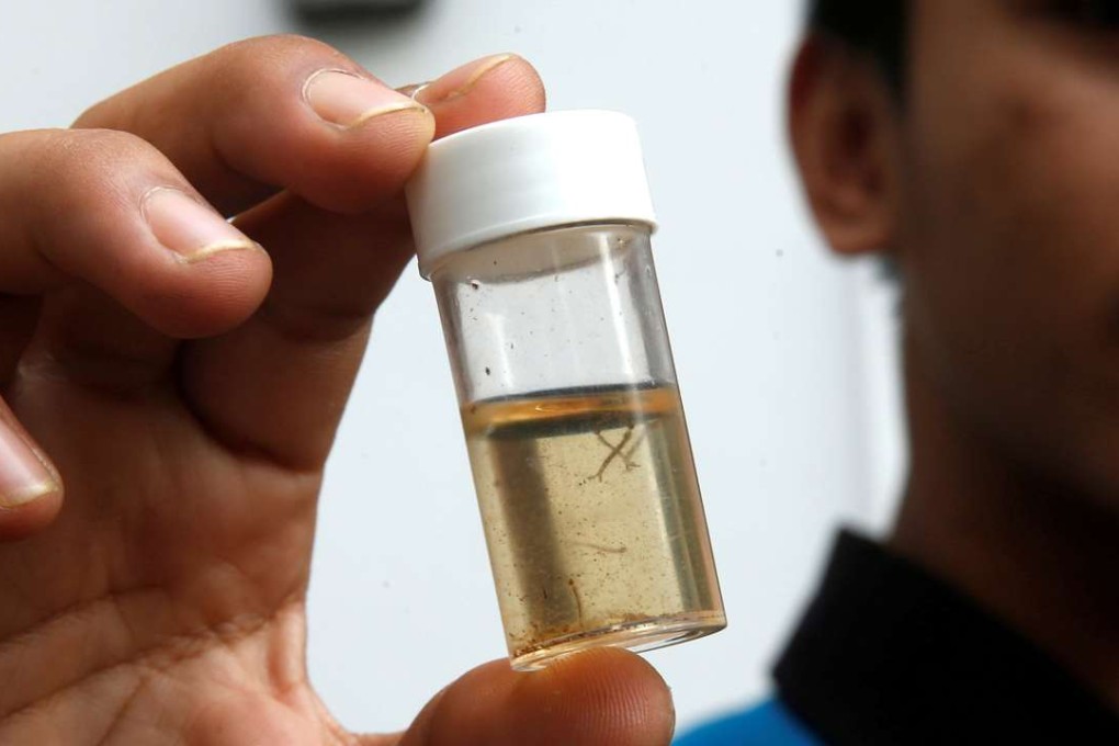 A member of a pest control team shows a container of mosquito larvae that they collected during their inspection at Zika clusters in Singapore. Photo: Reuters