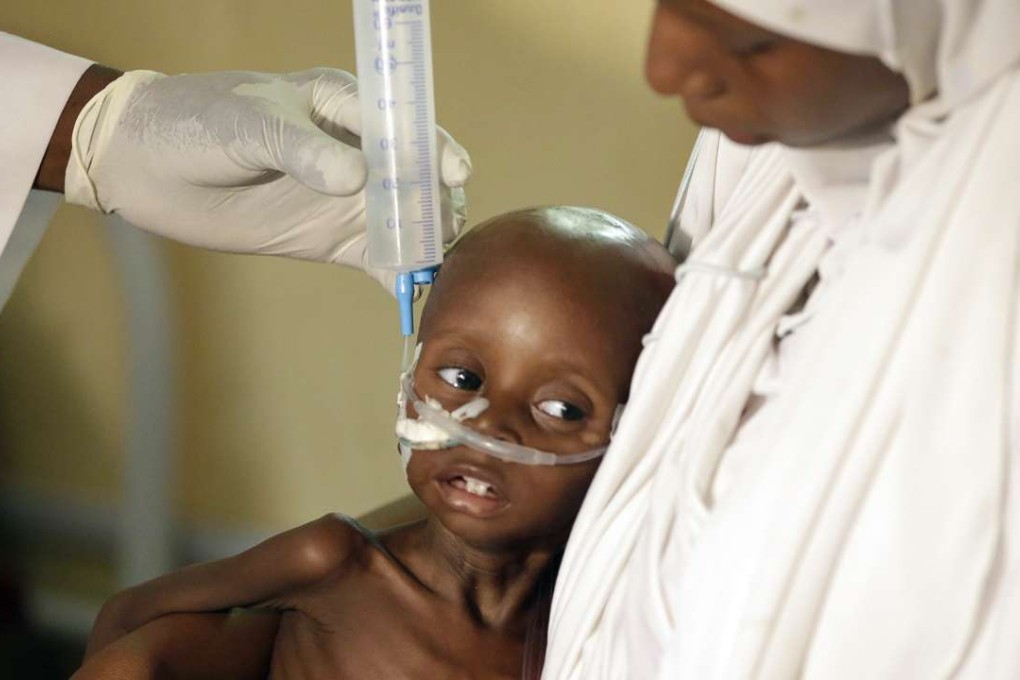 A doctor feeds a malnourished child at a feeding centre in Maiduguri, Nigeria. Photo: AP