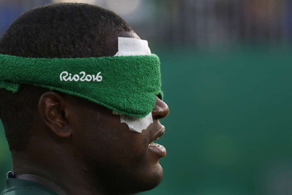 Brazil’s Jeferson da Conceicao Goncalves has lit up the Paralympics soccer competition in Rio. Photo: AP