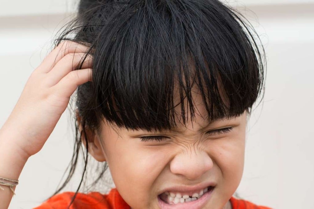 This Shutterstock image shows a girl with headlice. [FEATURES]
