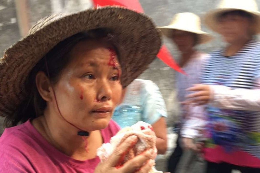 An injured villager in Wukan, Guangdong province. Photo: SCMP Pictures