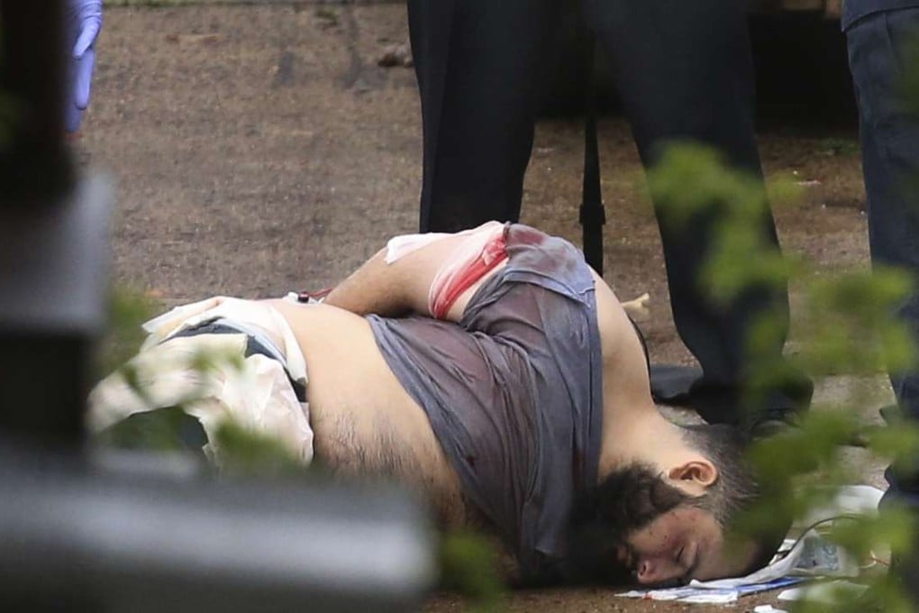 A police officer stands guard over an injured Ahmad Khan Rahami before Rahami was taken away from the scene of a shootout with police. Photo: AP