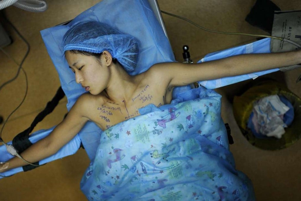 A patient undergoes a breast implant surgery at a hospital in Anhui province. Photo: Reuters