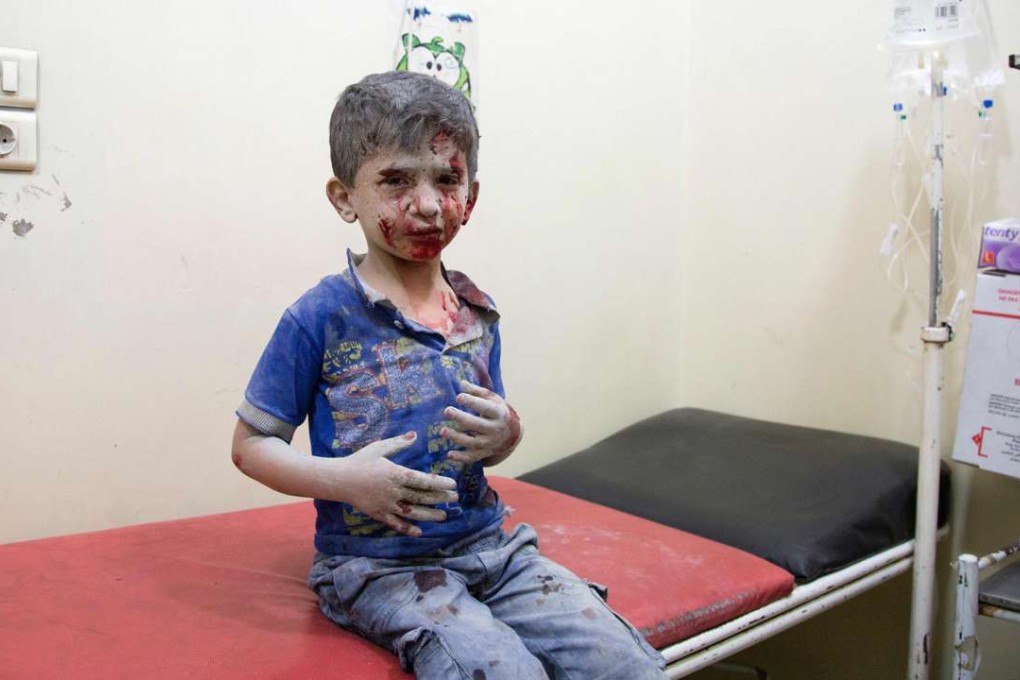 A Syrian boy awaits treatment at a make-shift hospital following air strikes on rebel-held eastern areas of Aleppo. Photo: AFP