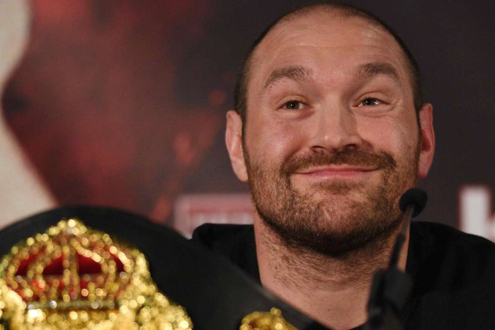 Tyson Fury. Photo: AFP