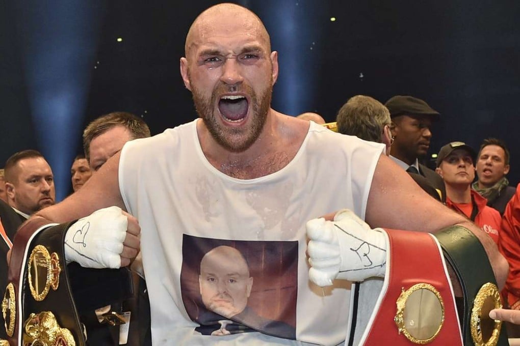 Britain’s Tyson Fuery is back in the news, making a U-turn on his retuirement tweet. Photo: AP