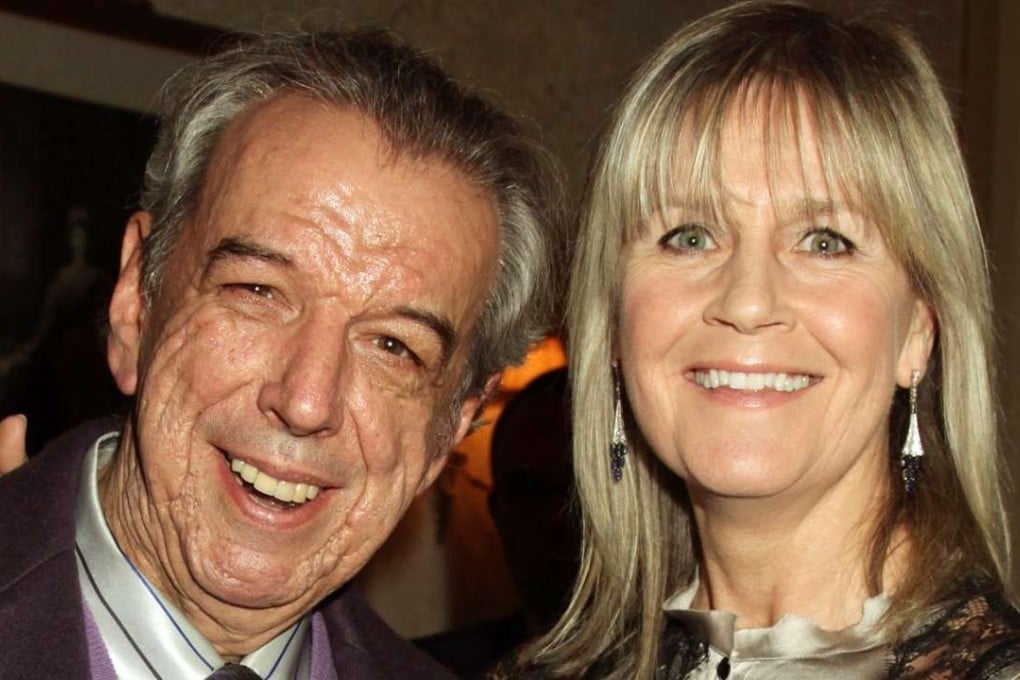 Songwriter Rod Temperton and his wife Kathy. Photo: AP