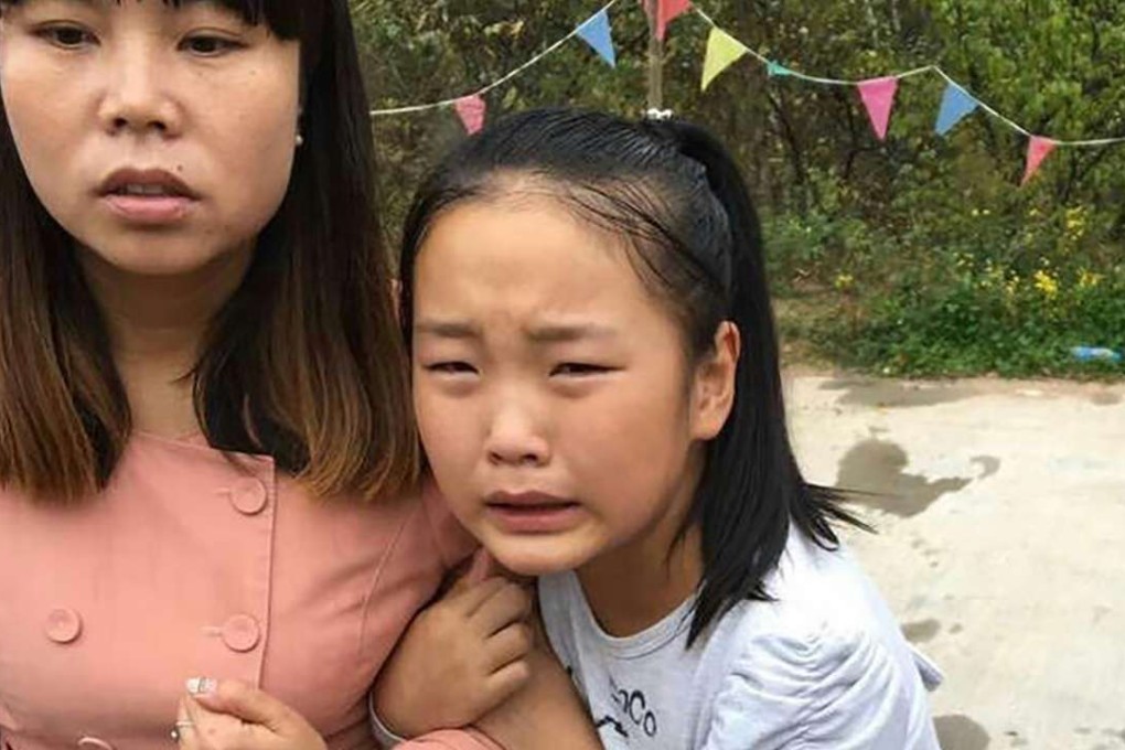 A weeping child holds on to her mother after she was stung by a swarm of bees while visiting a forest park in Shaanxi province on Tuesday. Photo: SCMP Pictures