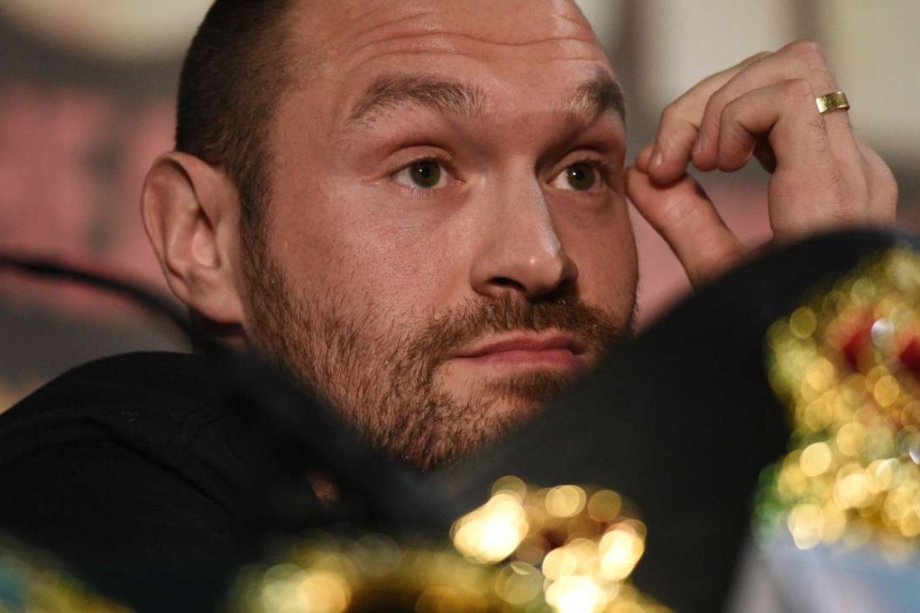 Tyson Fury. Photo: AFP
