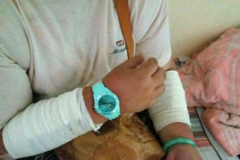 A mentally disabled woman at the Bridge of Rehabilitation Company's nursing home, who received sunburn injuries at another care facility after being relocated. Photo: SCMP Pictures