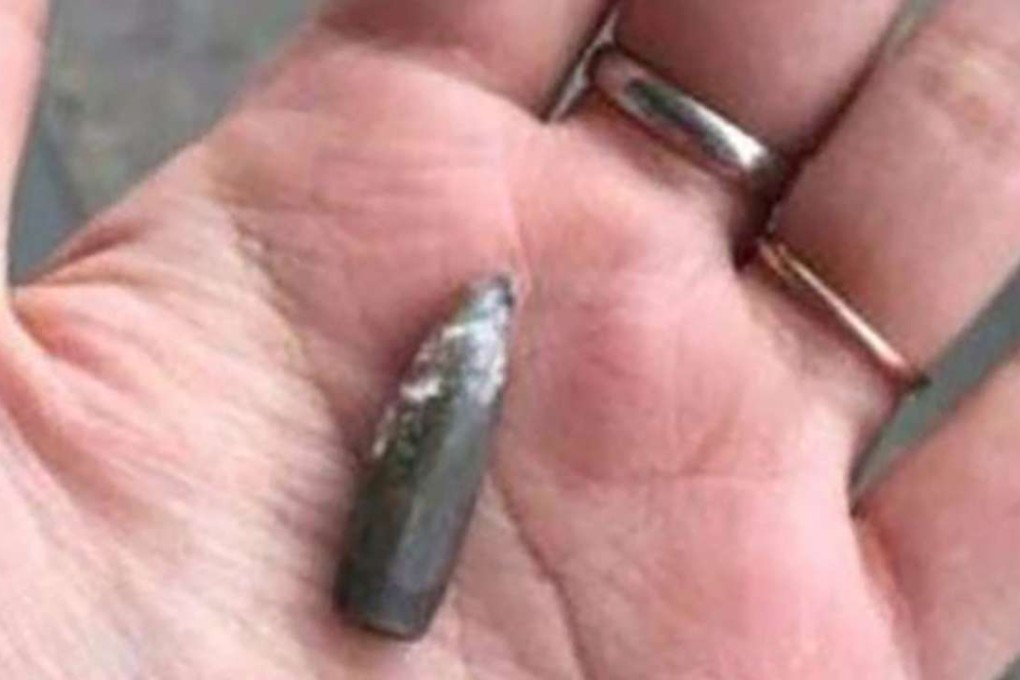 Qin Haixia holds the bullet which struck her in the waist in SEptember as she was out walking with her husband and baby in Nanjing last September. Photo: SCMP Pictures