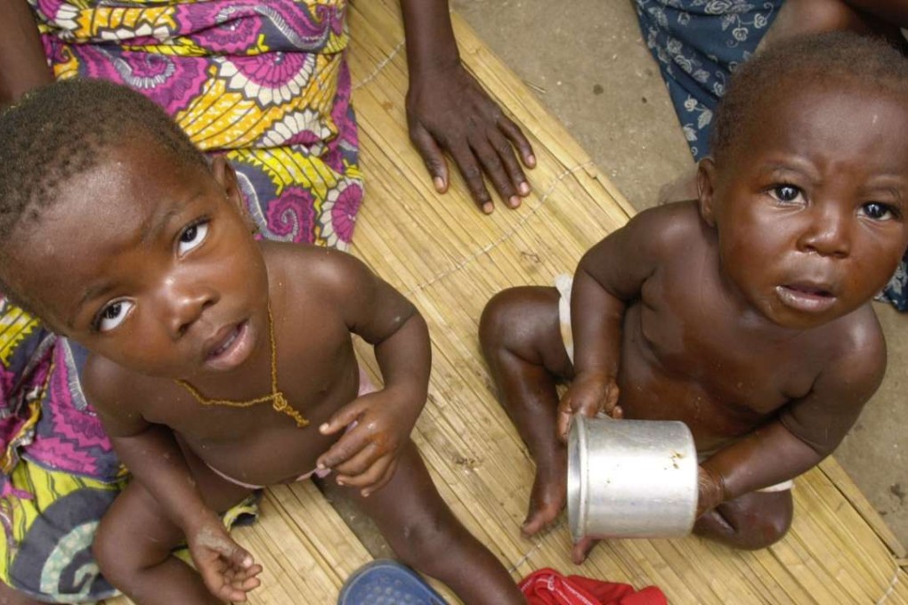 A mother and her two children wait to receive food at a refugee camp in Nabuangongo, Angola. Pneumonia is the most common cause of death among children in the impoverished African nation. Photo: AP