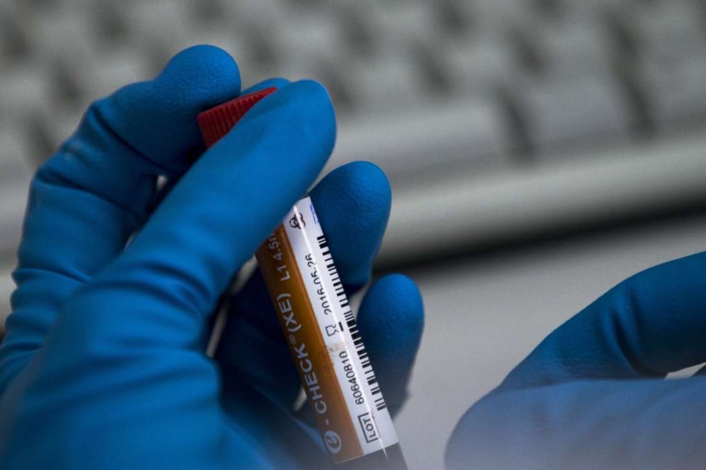 Wada has suspended an accredited testing lab in Doha after it failed to meet standards. Photo: AP