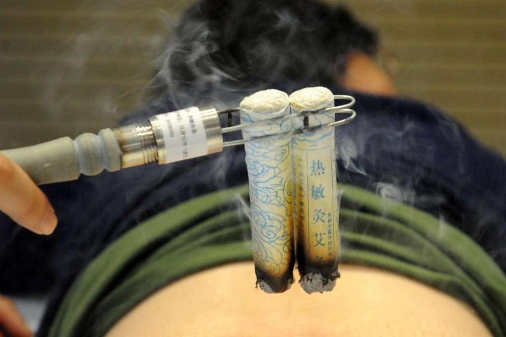 During moxibustion therapy, moxa sticks are lit and held over acupuncture points. Photo: Xinhua