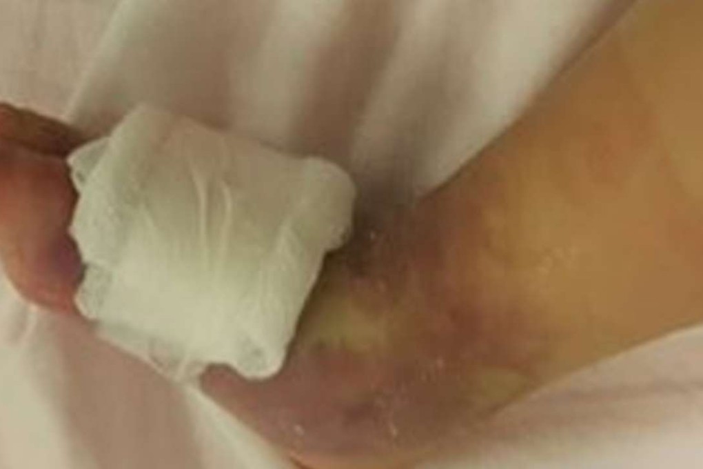 Parents of the affected girl revealed her condition on Facebook, claiming that medical staff were slow in discovering the trouble. Photo: SCMP