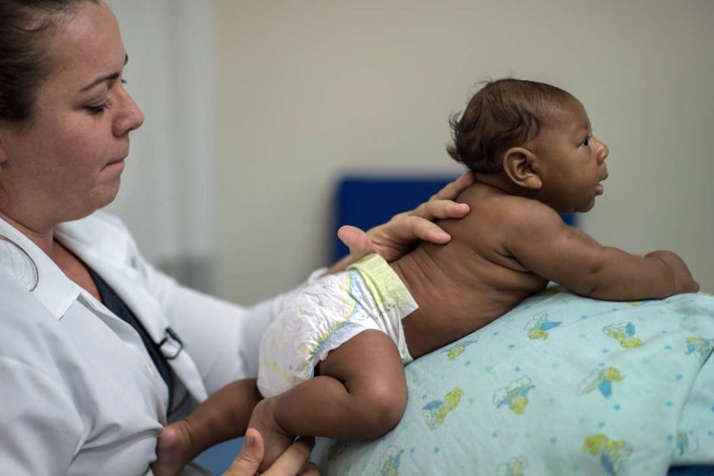 Physical therapist Isana Santana treats Ruan Hentique dos Santos, suffering from Zika-related microcephalia caught through an Aedes Aegypti mosquito bite, at a hospital in Salvador, Brazil. Photo: AFP