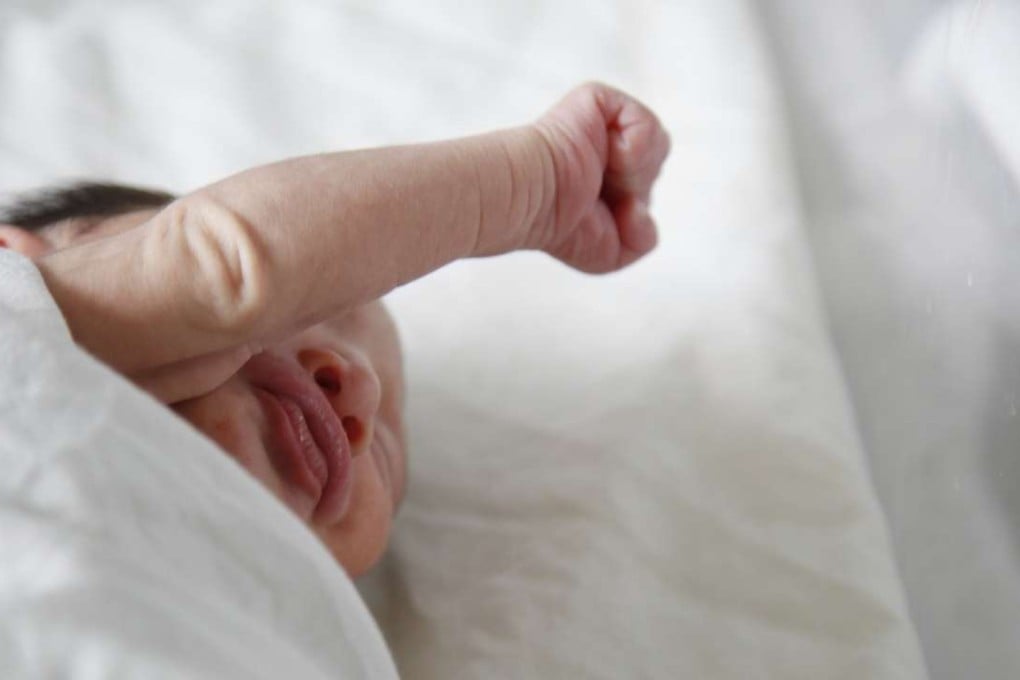 A newborn baby with microcephaly rests at a maternity ward of the University Hospital in Tegucigalpa, Honduras. Photo: AP