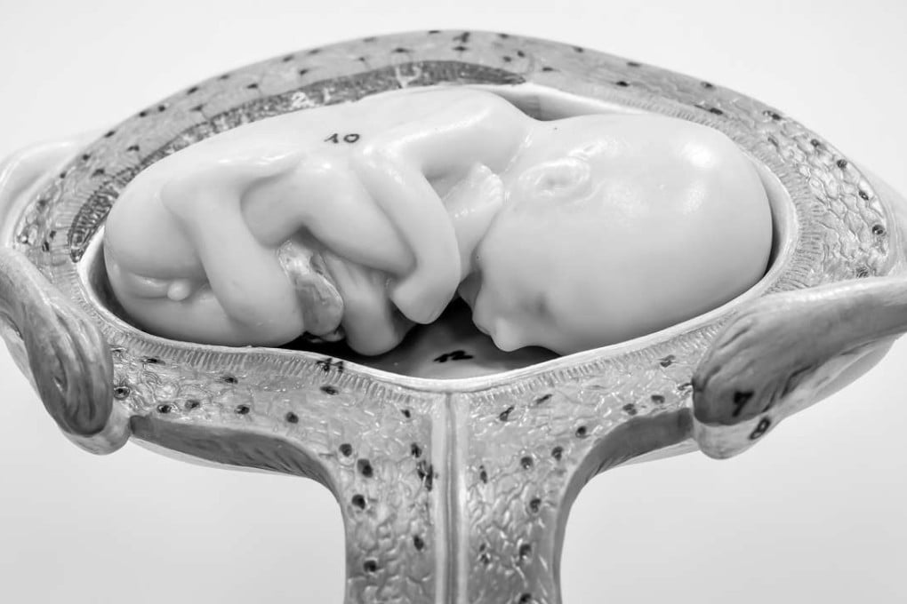 A model of a fetus and a placenta.