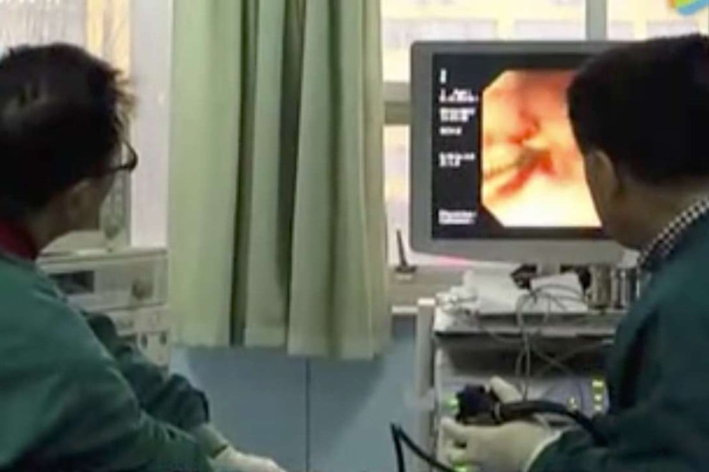 Dr Ju Weiping, left, watches a monitor showing the patient’s stomach as he removes a swallowed bottle cap. Photo: Qq.com