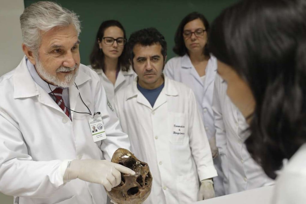 Forensic doctor Daniel Munoz shows the skull of Nazi war criminal Josef Mengele, at the school of medicine of Sao Paulo University in Sao Paulo. Photo: AP