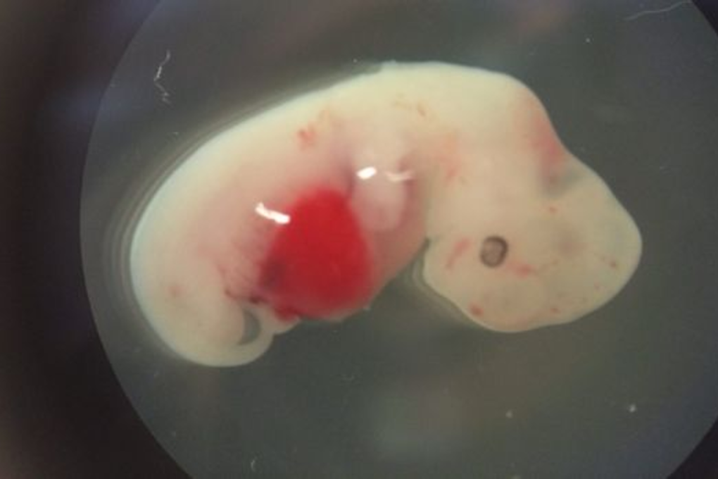 A four-week-old human-pig embryo. Photo: Salk Institute/Cell