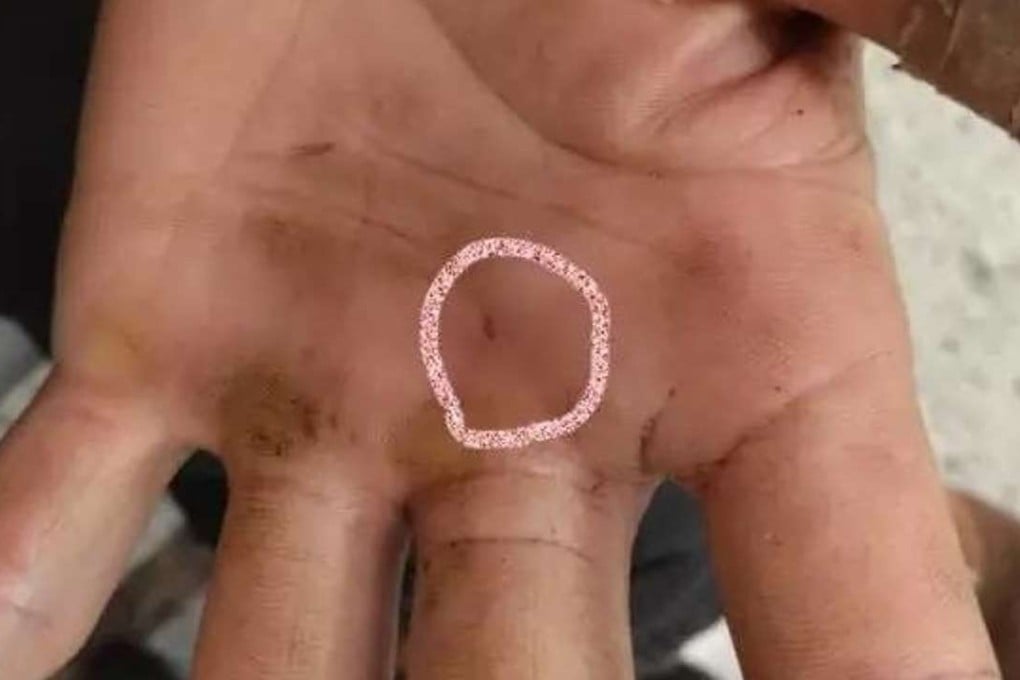 A puncture wound on the hand of the 60-year-old victim after he was bitten by the dead oriental rat snake. Photo: Handout