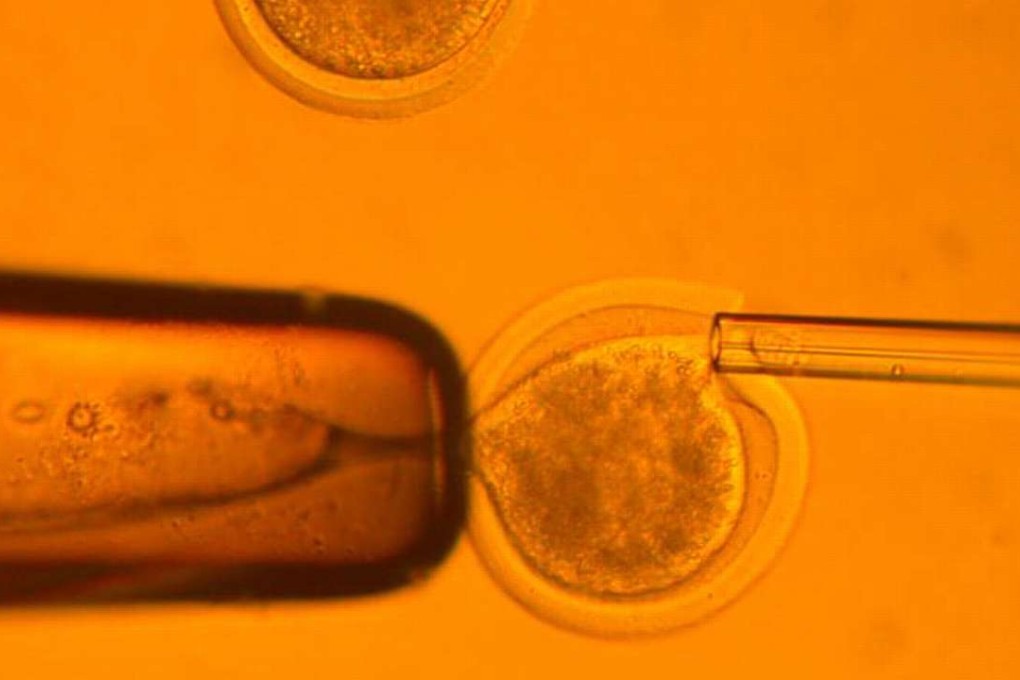 Human eggs are seen in an undated microscopic photo from the Seoul National University. Photo: Reuters