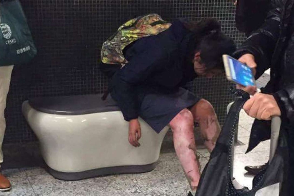 Female victim of Friday night’s arson attack. Photo: Facebook