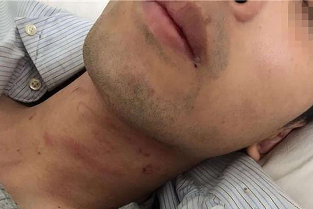 The Chinese tourist reportedly sustained fractures in three ribs, according to the report. Photo: Handout