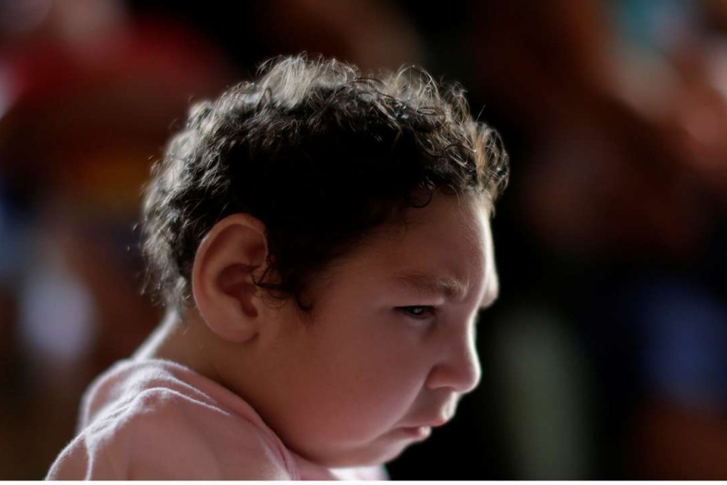 Heloisa, who has a twin sister named Heloa, both 10 months old and both born with microcephaly, is pictured at her house in Areia, Paraiba state, Brazil, on February 8. Photo: Reuters
