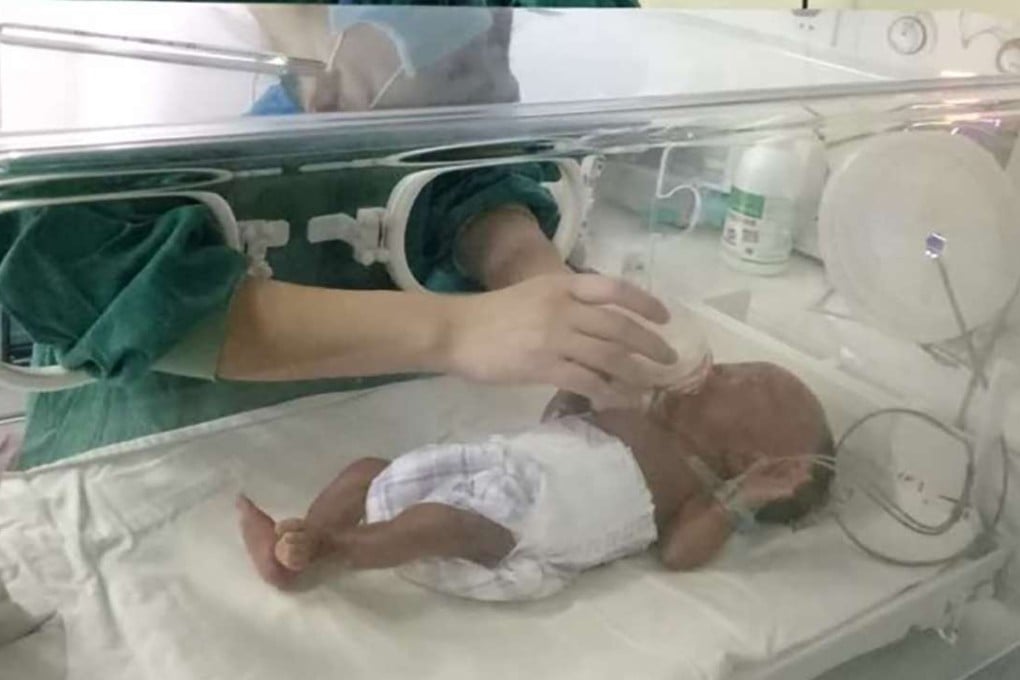 The baby receives care at a hospital in Guizhou province. Photo: Qq.com