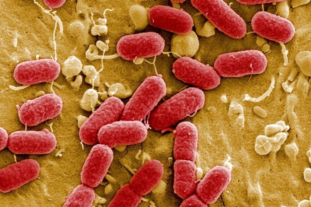 An undated image taken with electronic microscope shows EHEC bacteria (enterohaemorrhagic Escherichia coli) in the Helmholtz Centre for Infection Research in Brunswick, Germany. Photo: Reuters