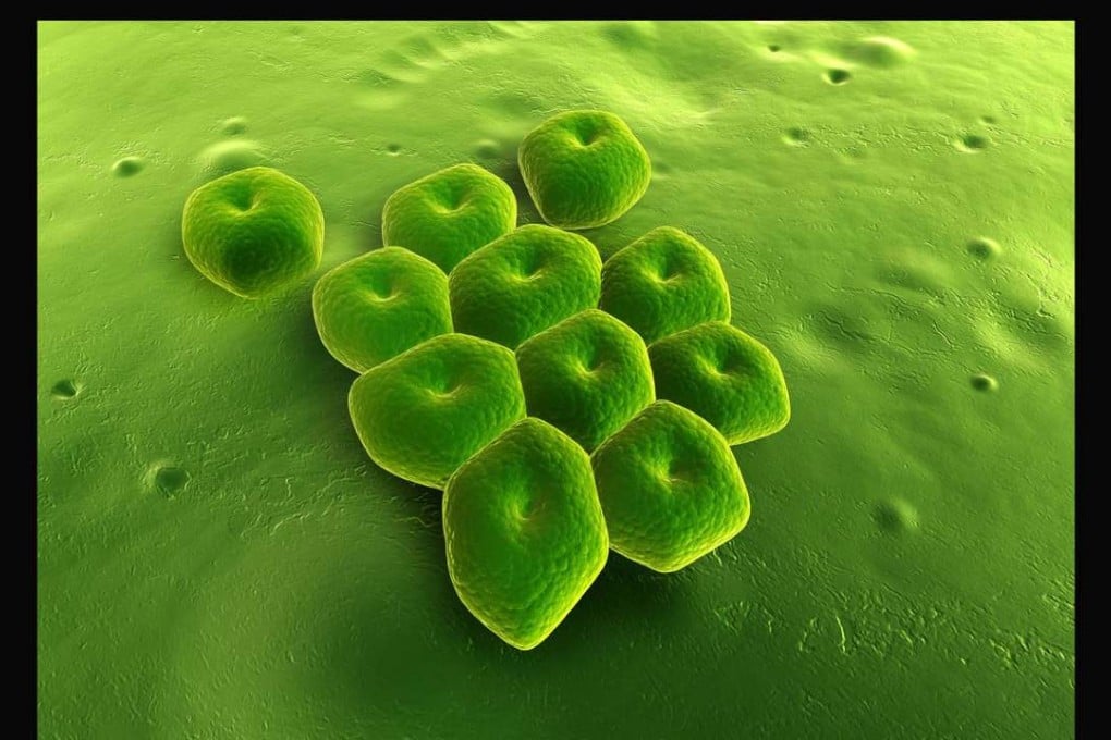 In some instances, the carbapenem-resistant Enterobacteriaceae, which US health officials have dubbed “nightmare bacteria”, kills up to 50 per cent of patients who become infected. Photo: Handout