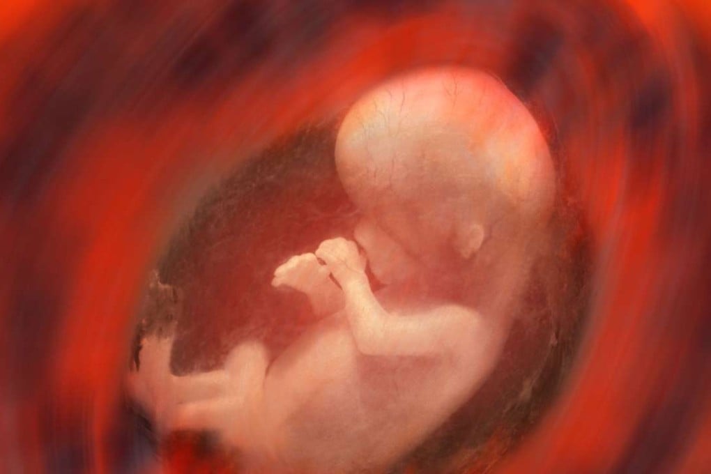 Indian police said they had found 19 aborted female foetuses dumped in a sewer . Photo: Handout