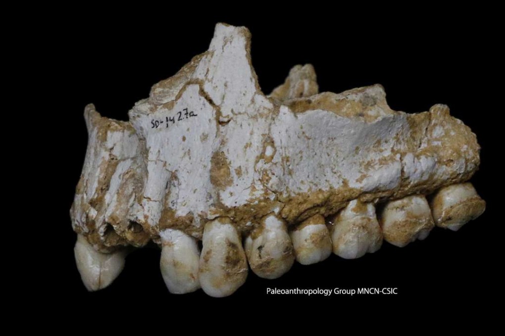 A handout photo released on March 7, 2017 by Paleoanthropology Group MNCN-CSIC shows the upper jaw of Neanderthal El Sidron 1, found in what is today Spain, with a dental calculus deposit visible on the rear molar (right).Photo: AFP
